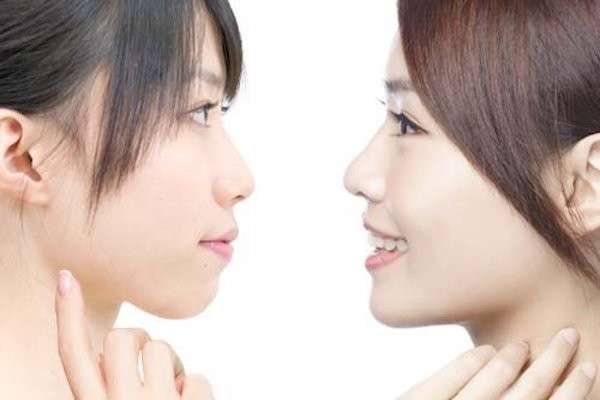 【プチ整形】あり？なし？どっち派？